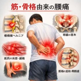 筋・骨格由来の腰痛